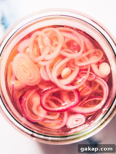 Easy Quick Pickled Shallots in a glass jar.