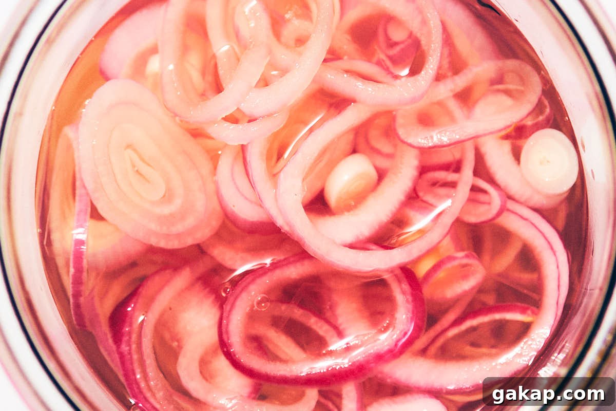Quick pickled shallots in a jar, ready to eat.