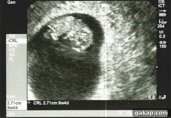 baby feis 2 ultrasound 7-8-13 rightside up